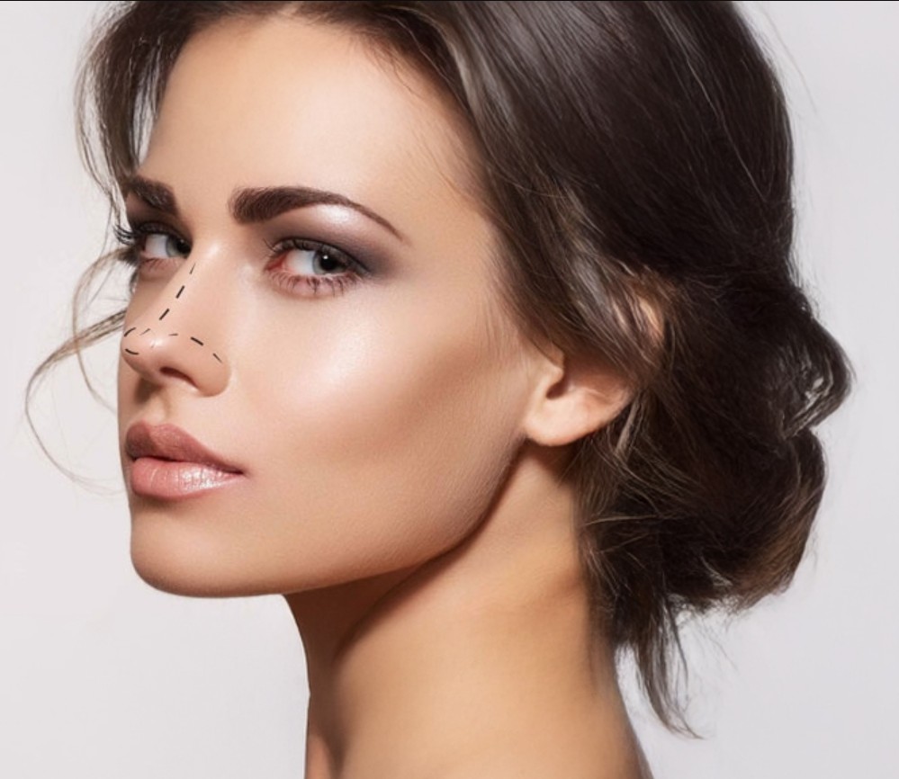 Kayseri meme estetiği